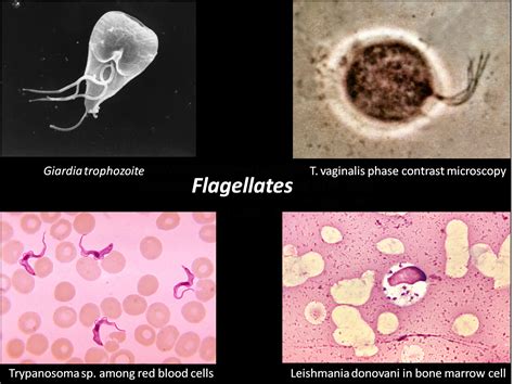  Acanthamoeba: Un'Incredibile Macchina di Sopravvivenza che si Sposta con Pseudopodi Fantastici!