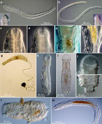  Gastrotrich! Un piccolo gigante del mondo microscopico 