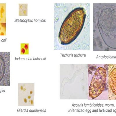  Monocercomonoides: Un Parassita Microscopico che Sfida le Normali Classificazioni!