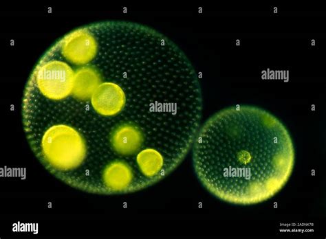   Yellow-Green Algae: Un enigmatico flagellato che danza tra luce e fotosintesi! 